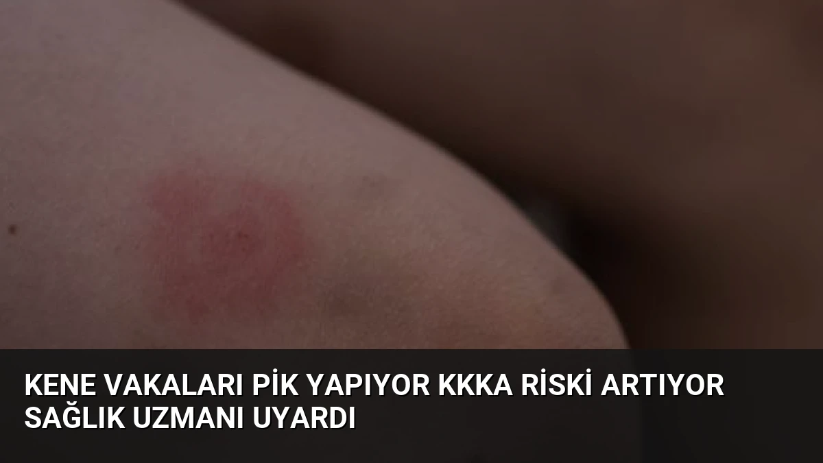 Kene Vakaları Pik Yapıyor KKKA Riski Artıyor Sağlık Uzmanı Uyardı