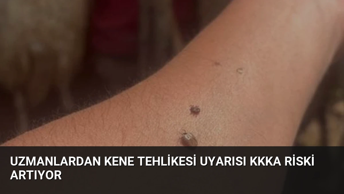 Uzmanlardan Kene Tehlikesi Uyarısı KKKA Riski Artıyor
