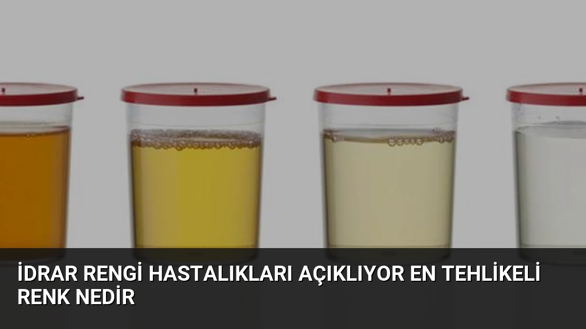 İdrar Rengi Hastalıkları Açıklıyor En Tehlikeli Renk Nedir